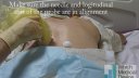 Adrenal biopsy using ultrasound
